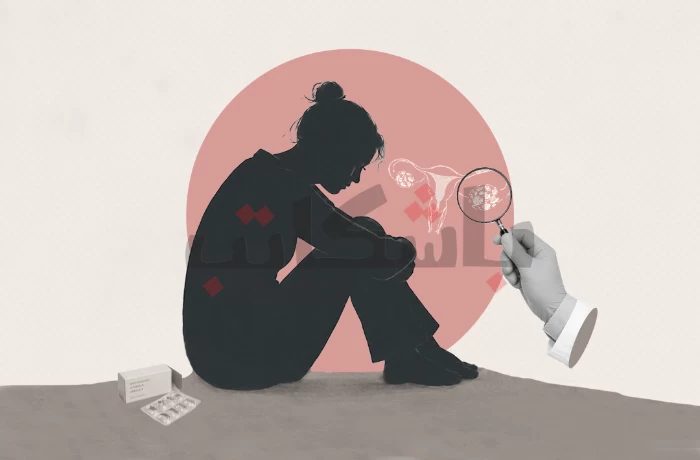 تكيس المبايض.. نساء يواجهن الألم دون تشخيص أو علاج