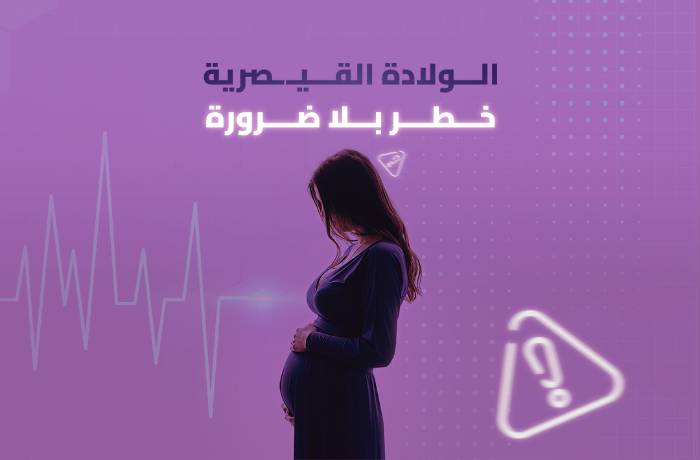 الولادة القيصرية بدون مبرر طبي.. هروب من الألم ولكن ماذا عن أضرارها؟